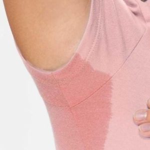 HYPERHIDROSIS (EXCESSIVE SWEATING)